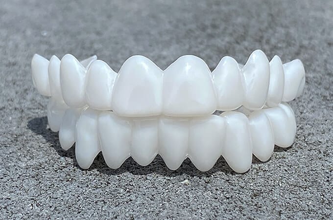 Facettes Dentaires DentAlign – Ajustement Naturel et Confortable, Matériau Composite Durable, Amélioration Rapide du Sourire 1