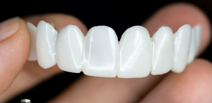 Facettes Dentaires DentAlign – Ajustement Naturel et Confortable, Matériau Composite Durable, Amélioration Rapide du Sourire 3