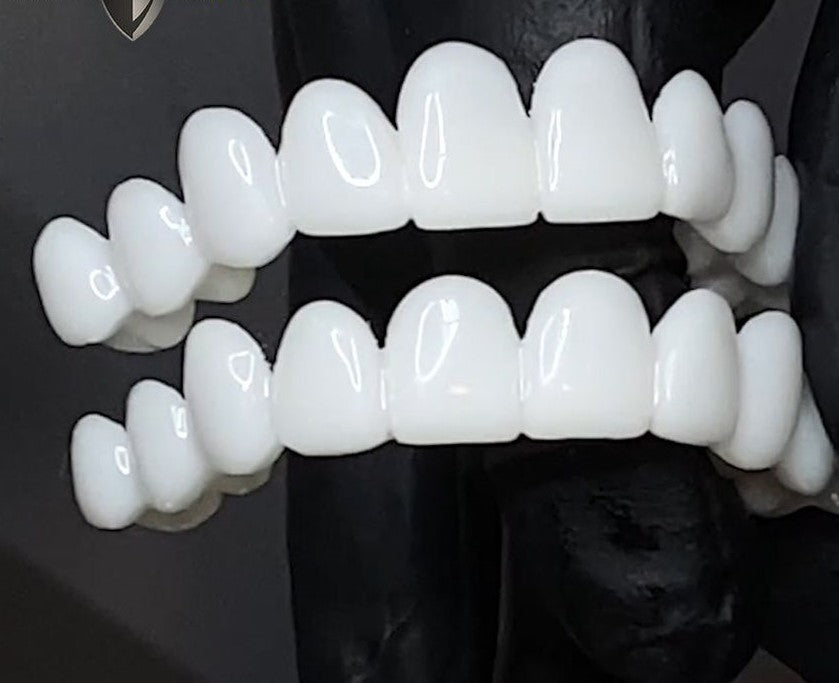 Facettes Dentaires DentAlign – Ajustement Naturel et Confortable, Matériau Composite Durable, Amélioration Rapide du Sourire 4